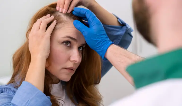What Causes Dandruff? How to Solve Dandruff Problem?